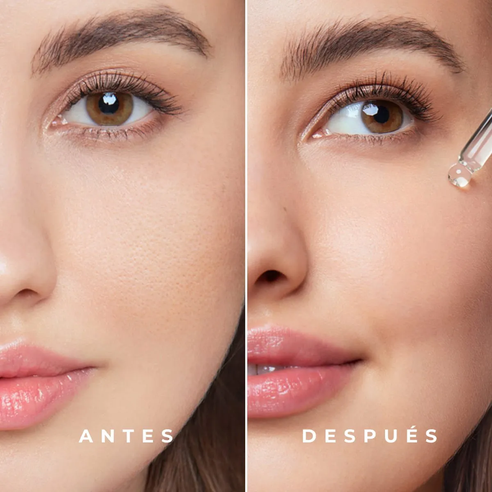 Suero Facial Anti-Imperfecciones Triple Acción Max