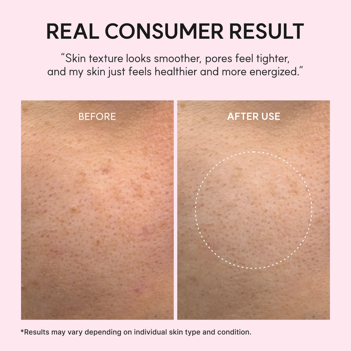 Arencia PDRN Booster Shot Serum