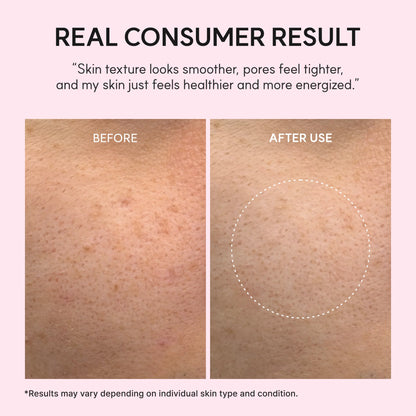 Arencia PDRN Booster Shot Serum