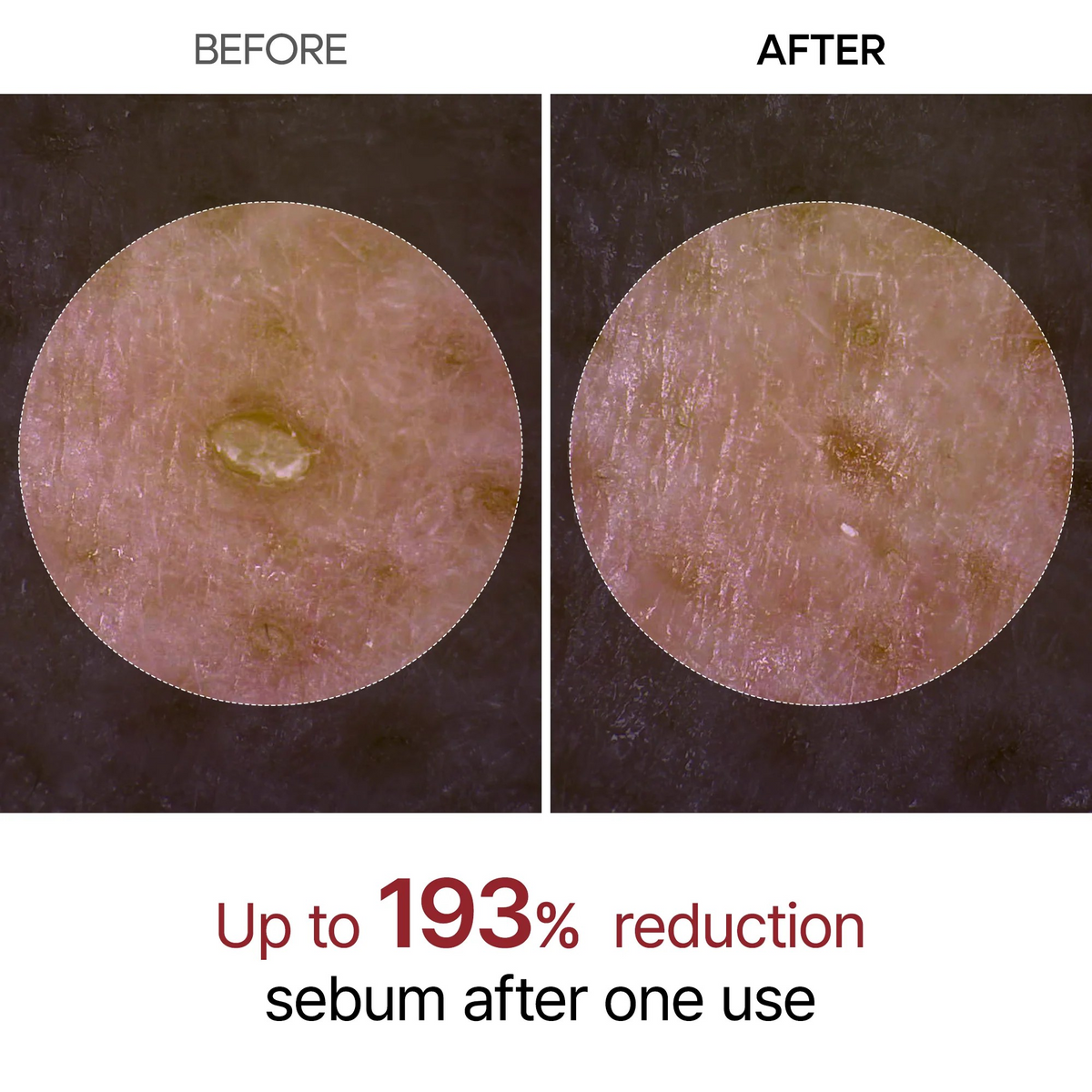 Dr. Melaxin Ampolla Exfoliante de Arroz Negro Peel Shot Glow