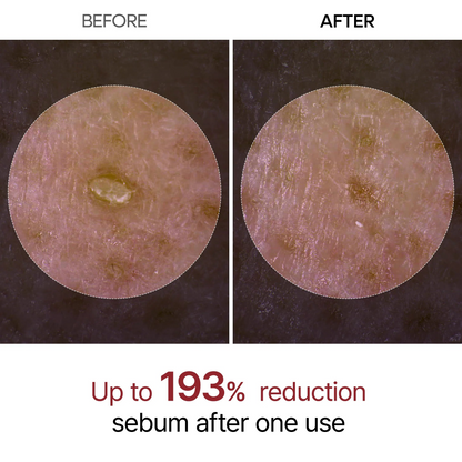 Dr. Melaxin Ampolla Exfoliante de Arroz Negro Peel Shot Glow